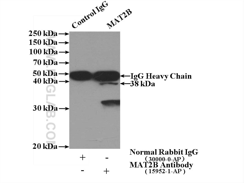 Immunoprecipitation (IP) experiment of HepG2 cells using MAT2B Polyclonal antibody (15952-1-AP)