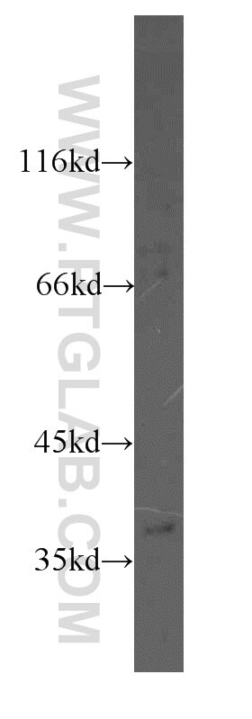 Western Blot (WB) analysis of mouse brain tissue using MAT2B Polyclonal antibody (15952-1-AP)