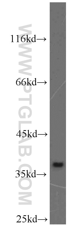 Western Blot (WB) analysis of HepG2 cells using MAT2B Polyclonal antibody (15952-1-AP)