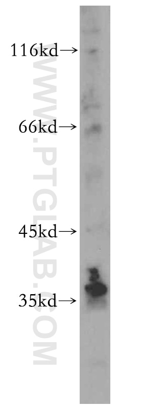 Western Blot (WB) analysis of Jurkat cells using MAT2B Polyclonal antibody (15952-1-AP)
