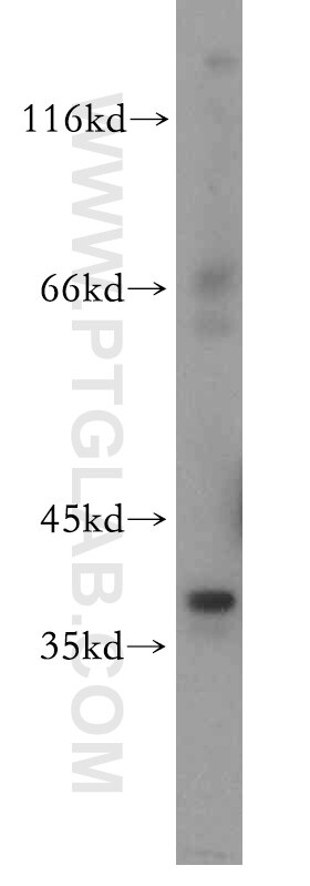 Western Blot (WB) analysis of HEK-293 cells using MAT2B Polyclonal antibody (15952-1-AP)