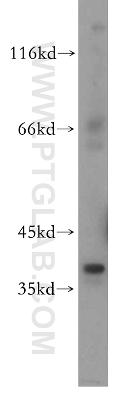 WB analysis of HEK-293 using 15952-1-AP