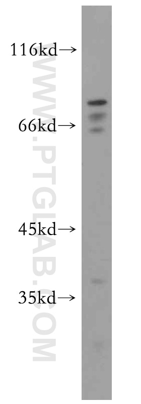 Western Blot (WB) analysis of mouse testis tissue using MAT2B Polyclonal antibody (15952-1-AP)