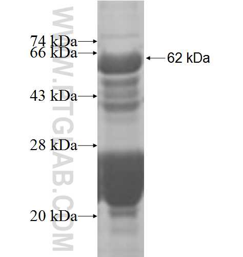 MAT2B fusion protein Ag8542 SDS-PAGE