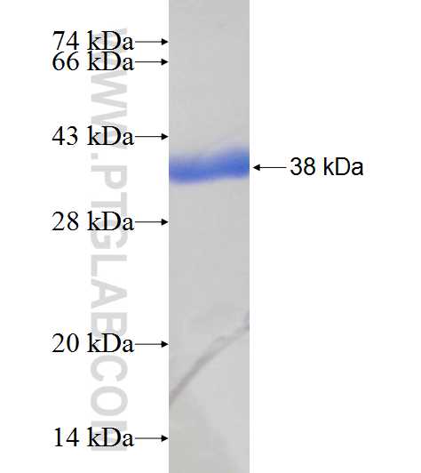 MAT2B fusion protein Ag8649 SDS-PAGE