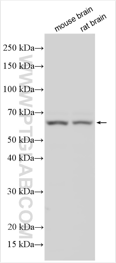 Western Blot (WB) analysis of various lysates using MATCHF1 Polyclonal antibody (24771-1-AP)