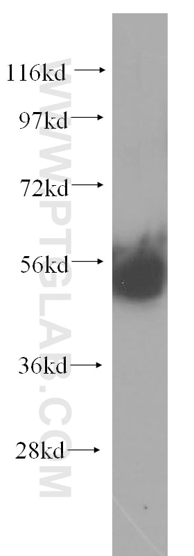 Western Blot (WB) analysis of mouse thymus tissue using MATK Polyclonal antibody (10082-2-AP)