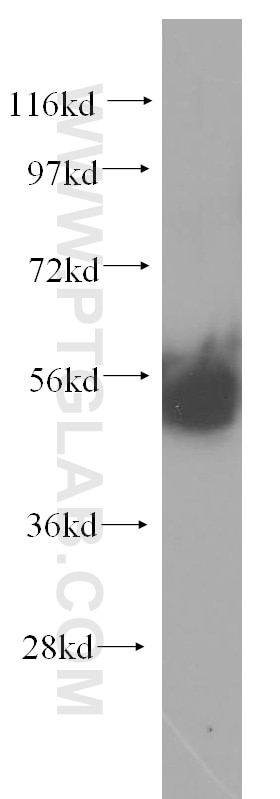 WB analysis of mouse thymus using 10082-2-AP