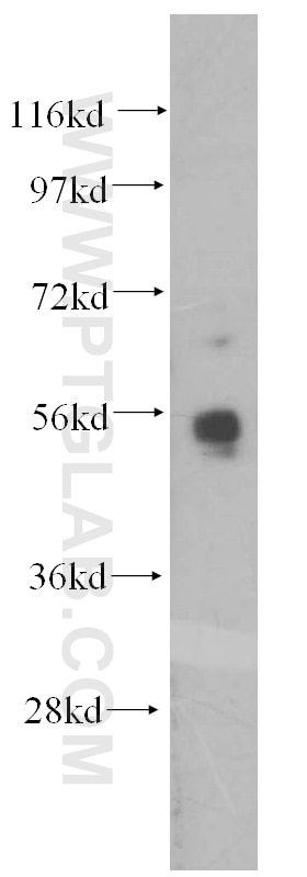 Western Blot (WB) analysis of K-562 cells using MATK Polyclonal antibody (10082-2-AP)