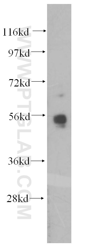 WB analysis of K-562 using 10082-2-AP