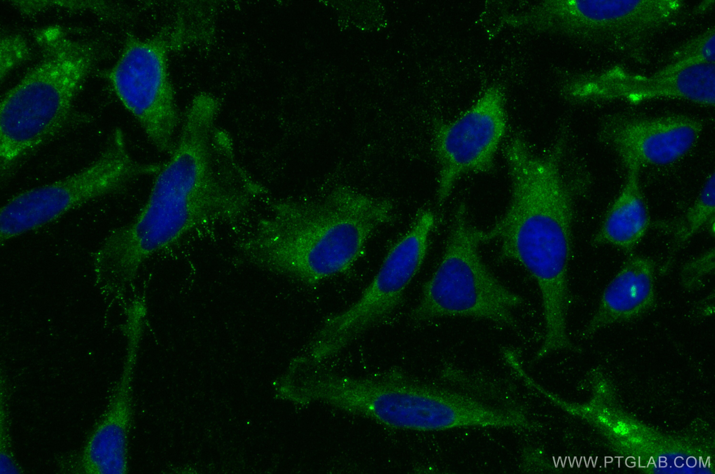 Immunofluorescence (IF) / fluorescent staining of HeLa cells using MATN1 Polyclonal antibody (28566-1-AP)