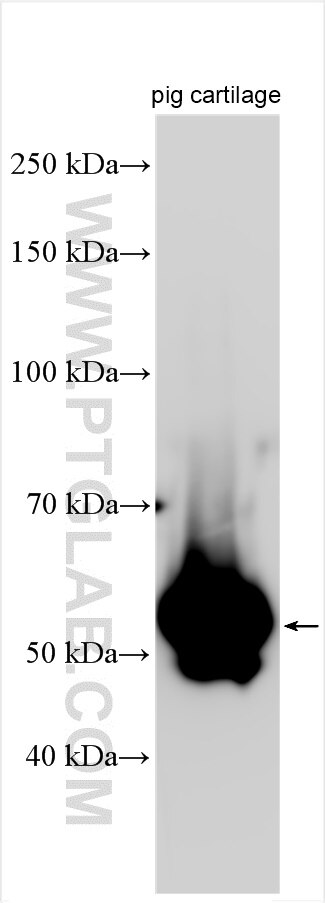 MATN1