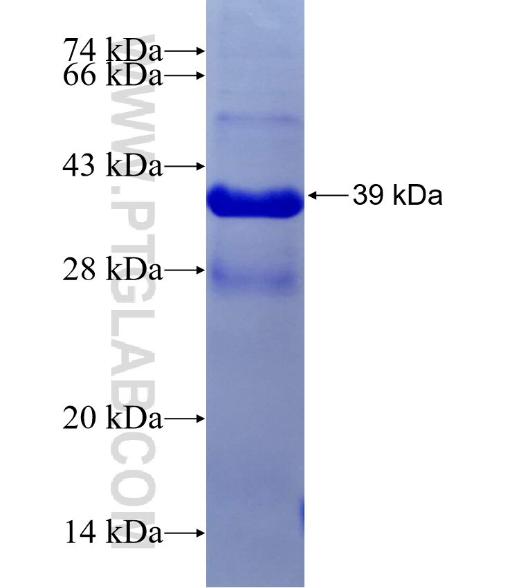 MATN1 fusion protein Ag29386 SDS-PAGE