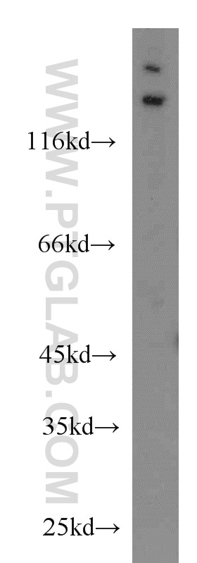 Western Blot (WB) analysis of HEK-293 cells using Matrilin 2 Polyclonal antibody (24064-1-AP)