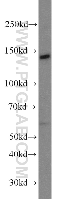 Western Blot (WB) analysis of NIH/3T3 cells using Matrilin 2 Polyclonal antibody (24064-1-AP)