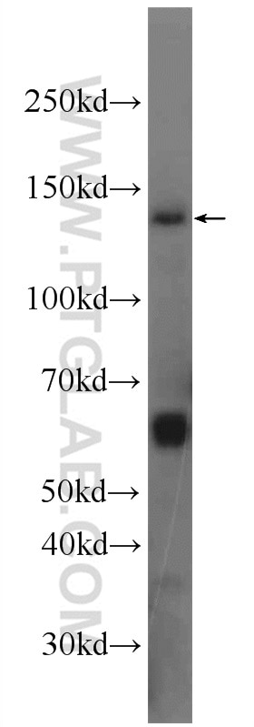 Western Blot (WB) analysis of mouse liver tissue using Matrilin 2 Polyclonal antibody (24064-1-AP)