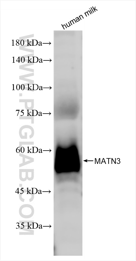 MATN3