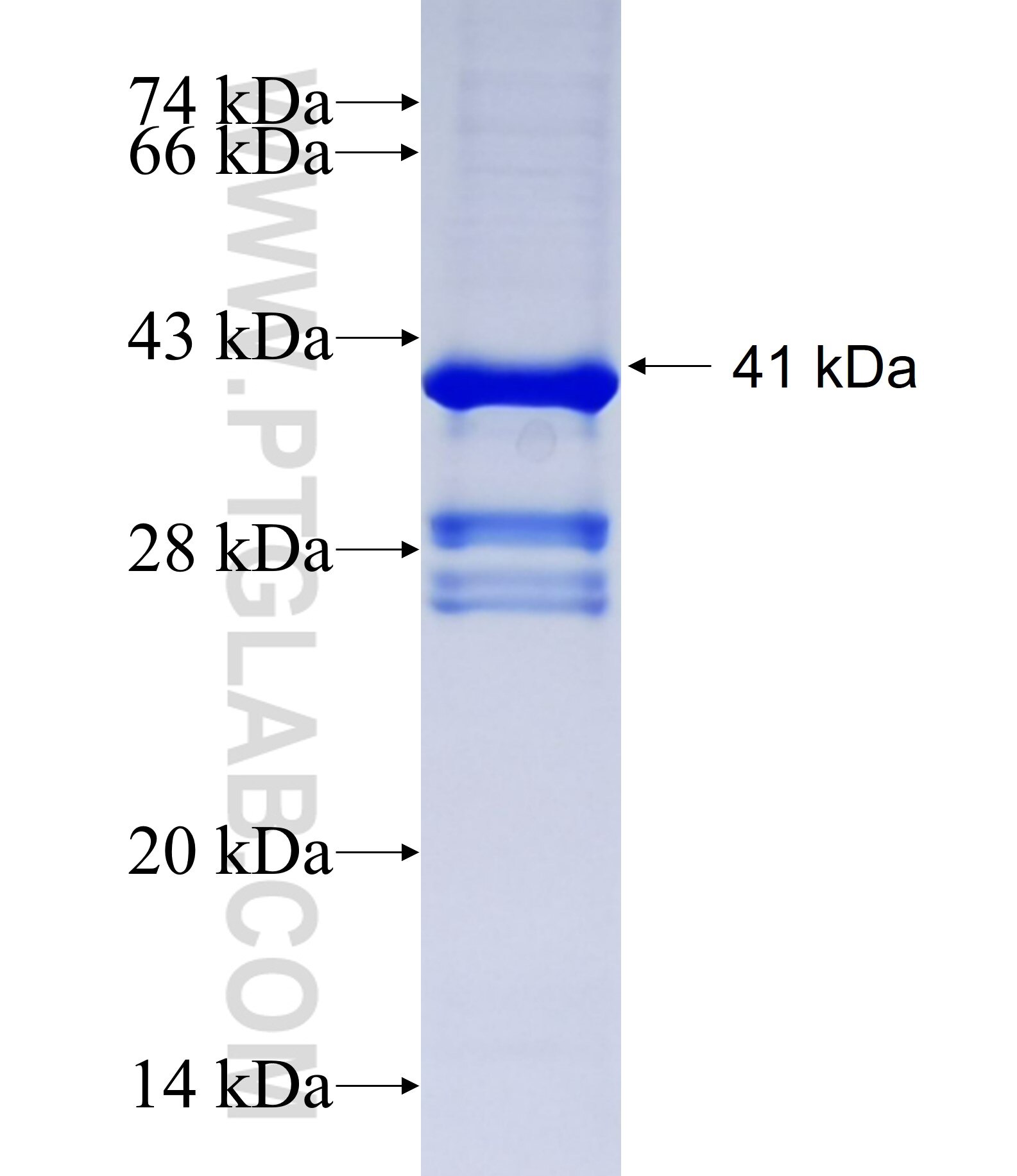 MATN3 fusion protein Ag21932 SDS-PAGE