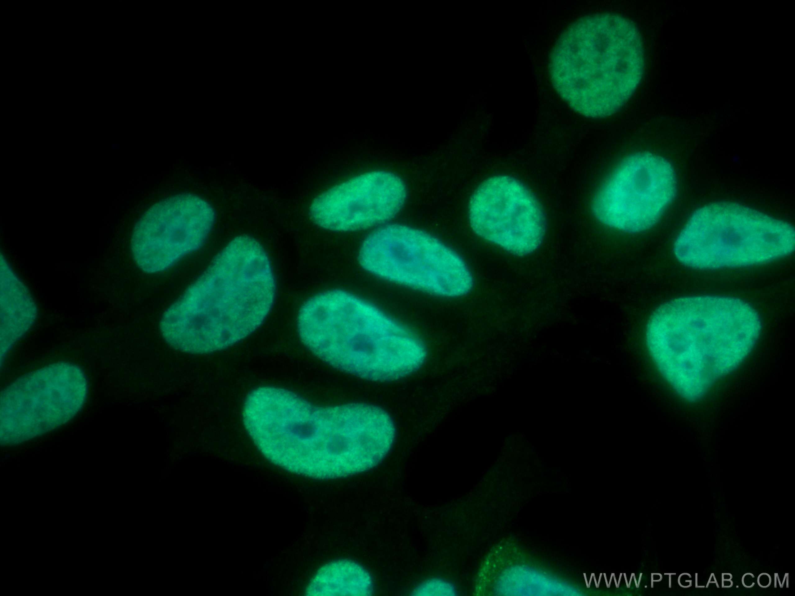 Immunofluorescence (IF) / fluorescent staining of HEK-293 cells using MATR3 Polyclonal antibody (12202-2-AP)