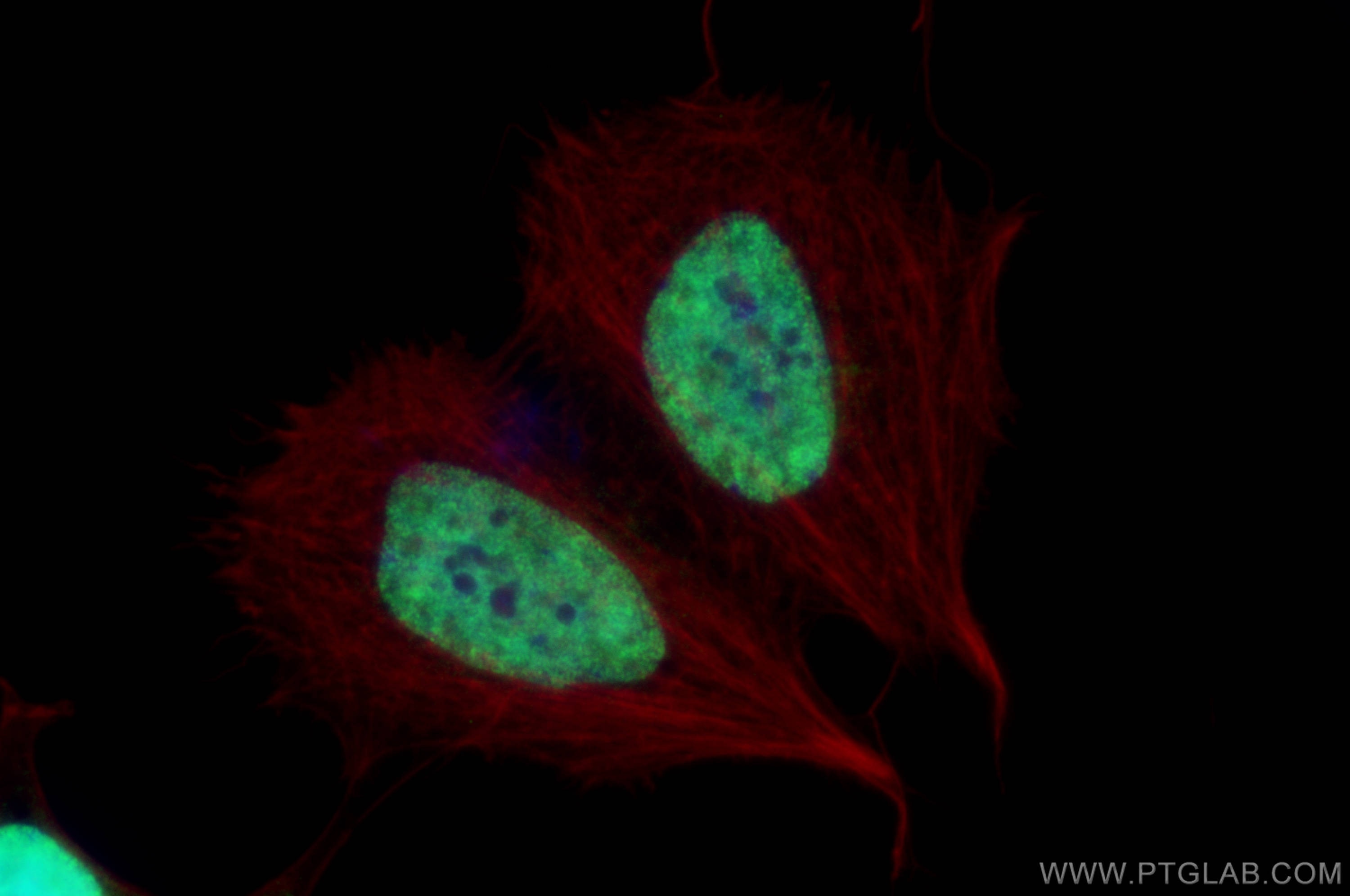 Immunofluorescence (IF) / fluorescent staining of SH-SY5Y cells using MATR3 Polyclonal antibody (12202-2-AP)