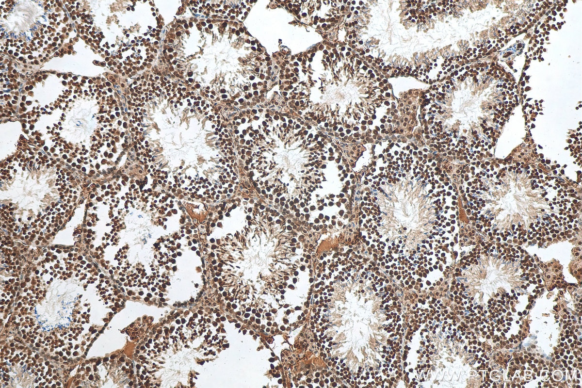 Immunohistochemistry (IHC) staining of mouse testis tissue using MATR3 Polyclonal antibody (12202-2-AP)