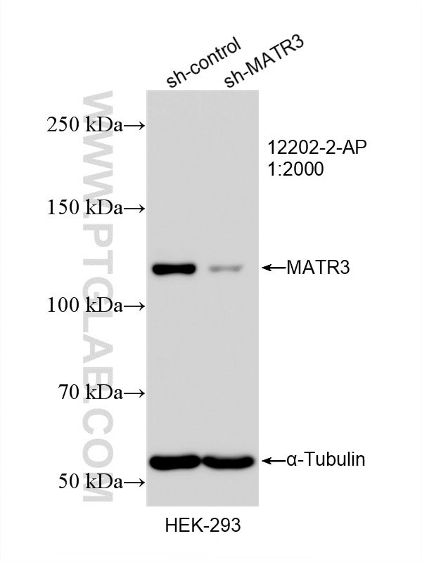 Western Blot (WB) analysis of HEK-293 cells using MATR3 Polyclonal antibody (12202-2-AP)