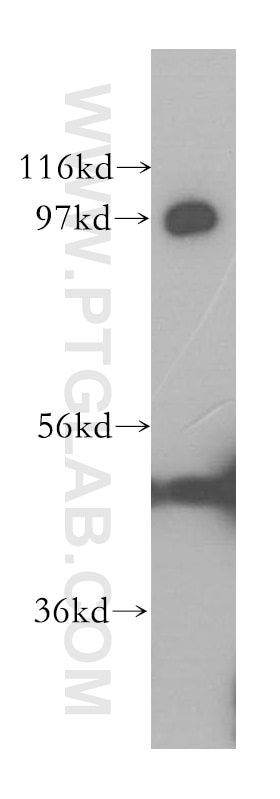 MATR3 Polyclonal antibody