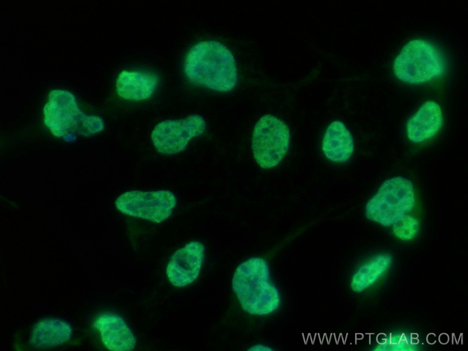 Immunofluorescence (IF) / fluorescent staining of HEK-293 cells using CoraLite® Plus 488-conjugated MATR3 Polyclonal ant (CL488-12202)