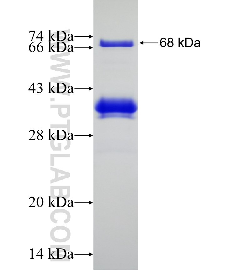 MATR3 fusion protein Ag2843 SDS-PAGE