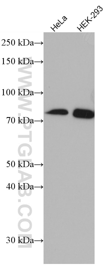 Western Blot (WB) analysis of various lysates using MAVS; VISA Monoclonal antibody (66911-1-Ig)