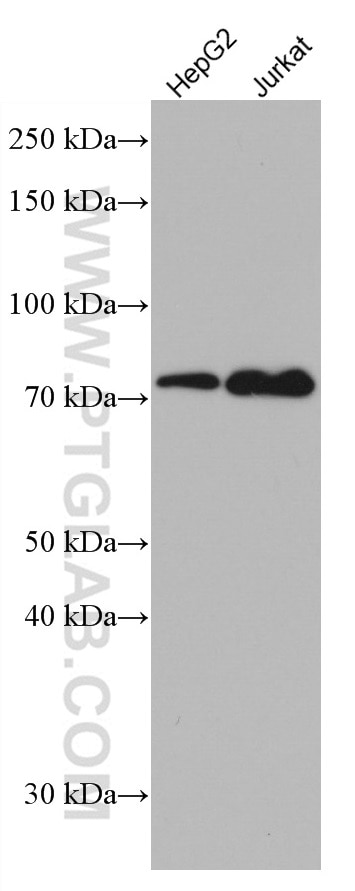 Western Blot (WB) analysis of various lysates using MAVS; VISA Monoclonal antibody (66911-1-Ig)