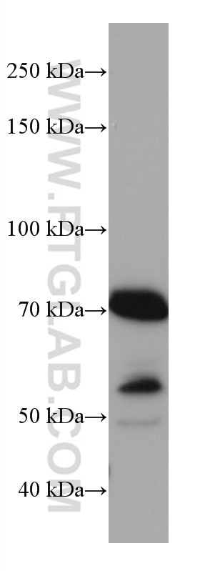 Western Blot (WB) analysis of A431 cells using MAVS; VISA Monoclonal antibody (66911-1-Ig)