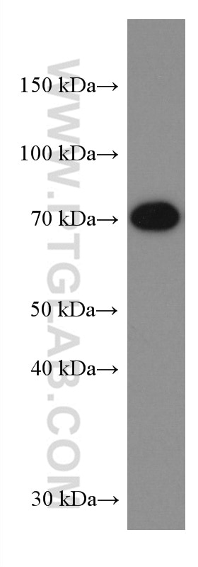 Western Blot (WB) analysis of Jurkat cells using MAVS; VISA Monoclonal antibody (66911-1-Ig)