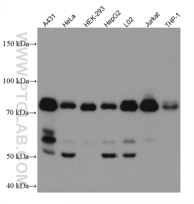 Western Blot (WB) analysis of various lysates using MAVS; VISA Monoclonal antibody (66911-1-Ig)