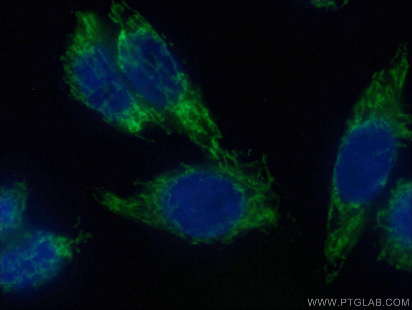 Immunofluorescence (IF) / fluorescent staining of HeLa cells using CoraLite® Plus 488-conjugated MAVS; VISA Polyclona (CL488-14341)