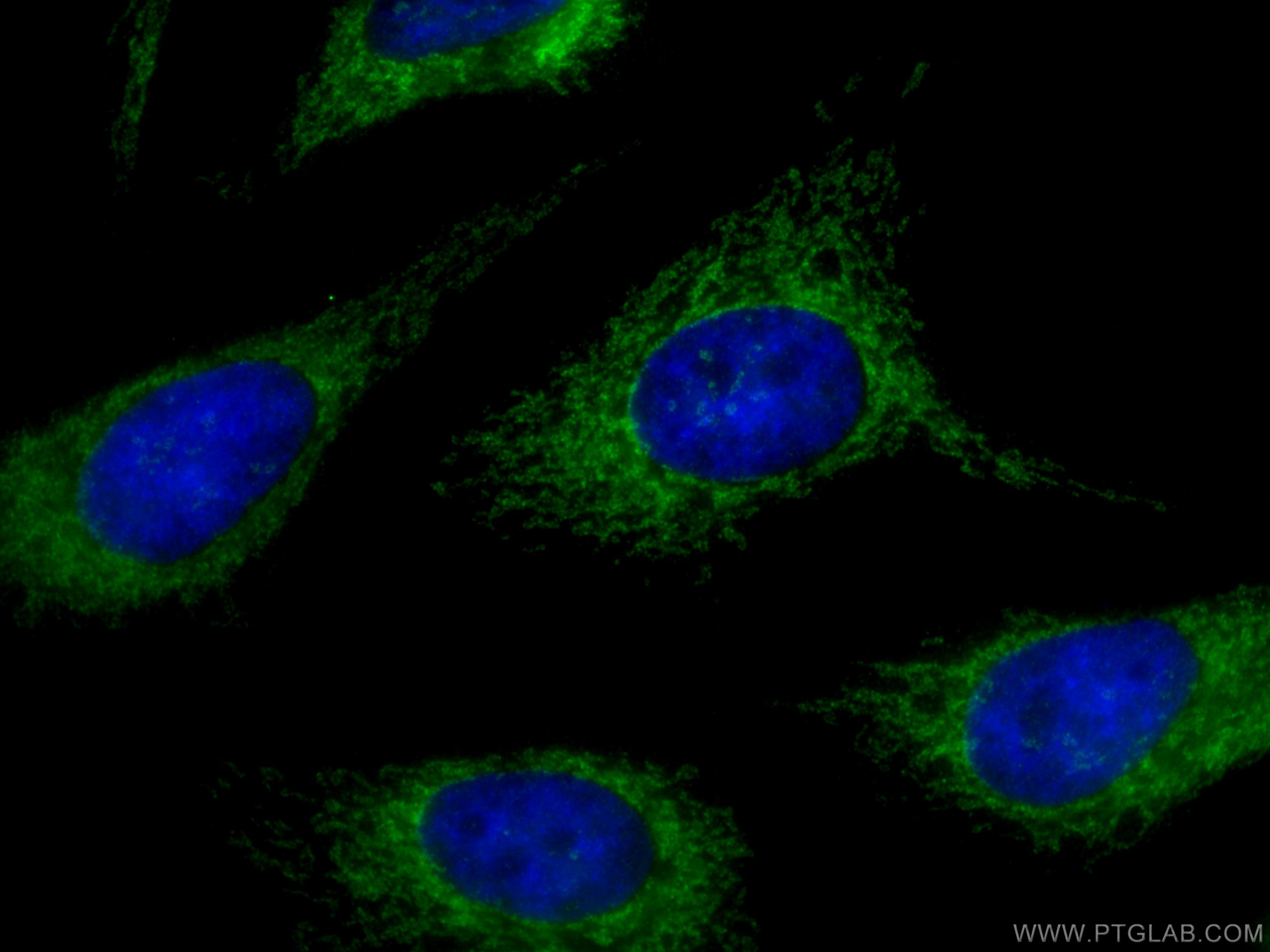 IF Staining of HeLa using 14341-1-AP