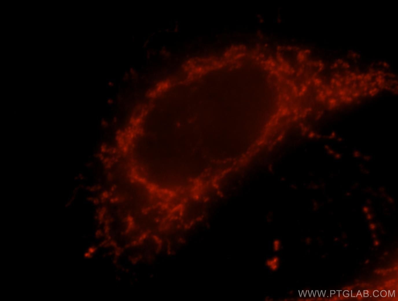 Immunofluorescence (IF) / fluorescent staining of HeLa cells using MAVS; VISA Polyclonal antibody (14341-1-AP)
