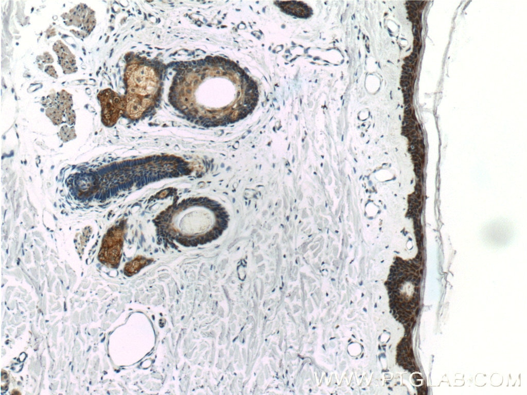 IHC staining of human skin using 14341-1-AP