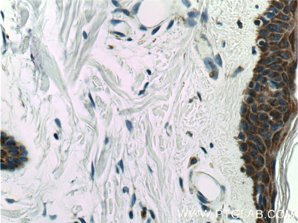 Immunohistochemistry (IHC) staining of human skin tissue using MAVS; VISA Polyclonal antibody (14341-1-AP)