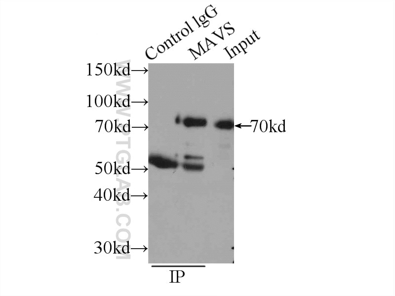 Immunoprecipitation (IP) experiment of HEK-293 cells using MAVS; VISA Polyclonal antibody (14341-1-AP)