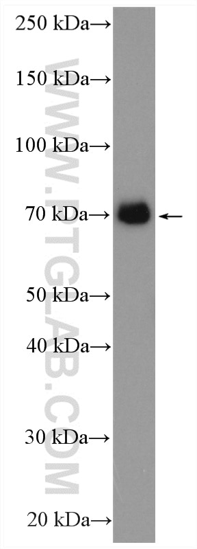Western Blot (WB) analysis of HeLa cells using MAVS; VISA Polyclonal antibody (14341-1-AP)