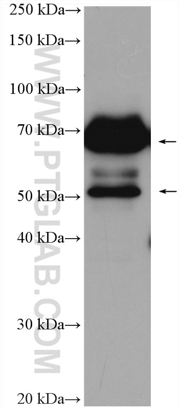 Western Blot (WB) analysis of HuH-7 cells using MAVS; VISA Polyclonal antibody (14341-1-AP)