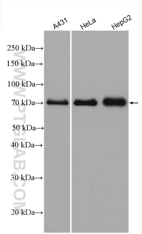 Western Blot (WB) analysis of various lysates using MAVS; VISA Polyclonal antibody (14341-1-AP)