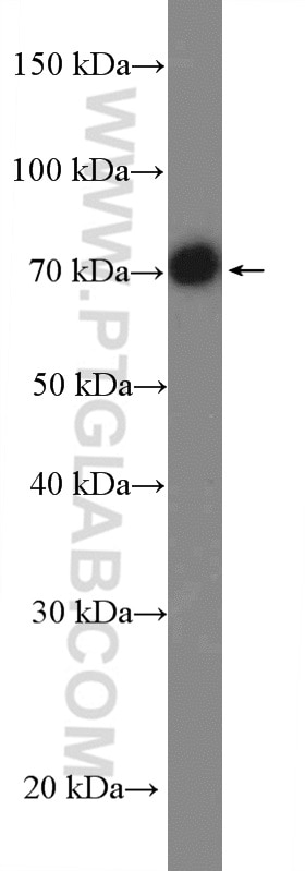 Western Blot (WB) analysis of Jurkat cells using MAVS; VISA Polyclonal antibody (14341-1-AP)