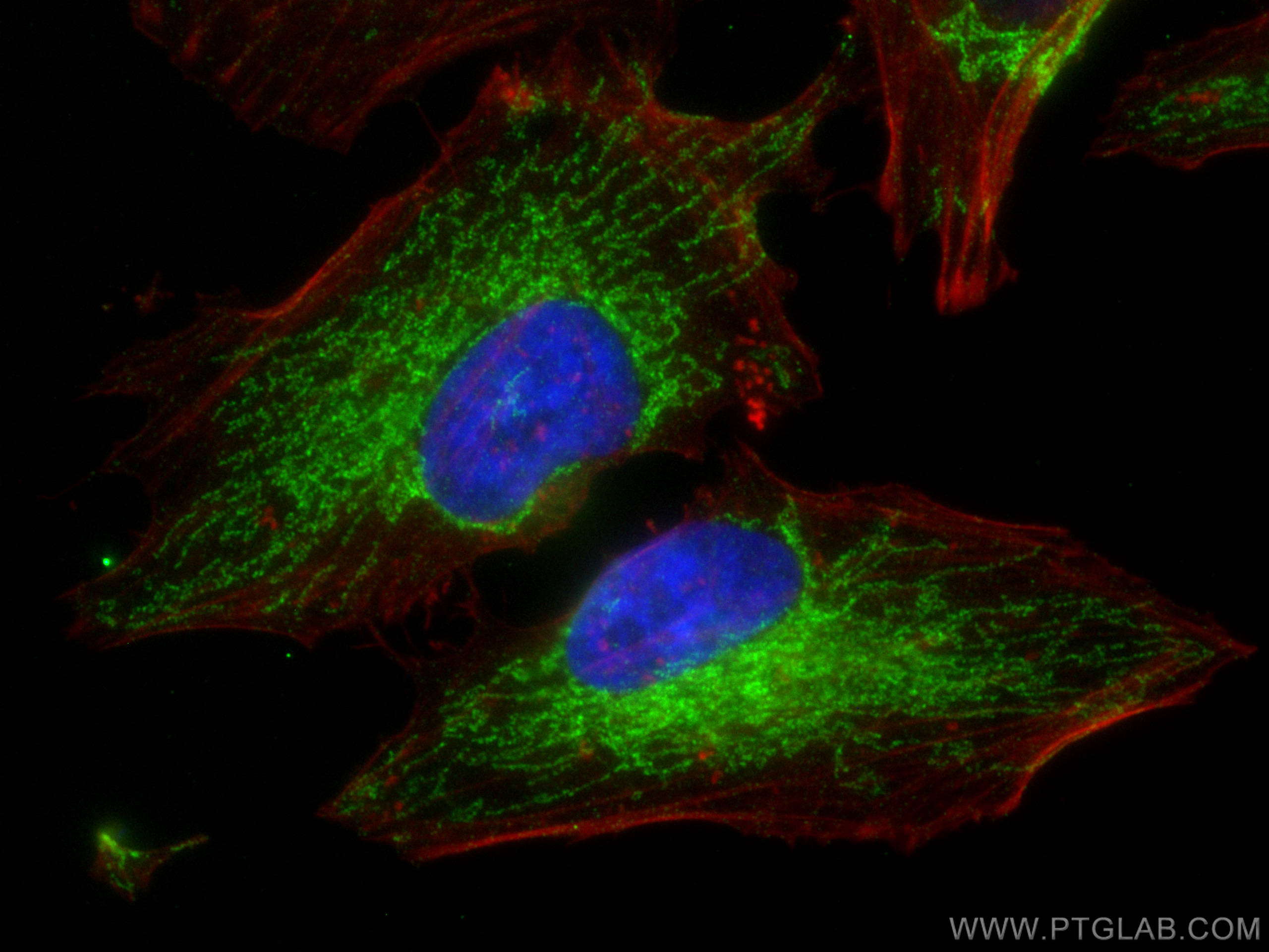 Immunofluorescence (IF) / fluorescent staining of HeLa cells using MAVS; VISA Recombinant antibody (81910-1-RR)