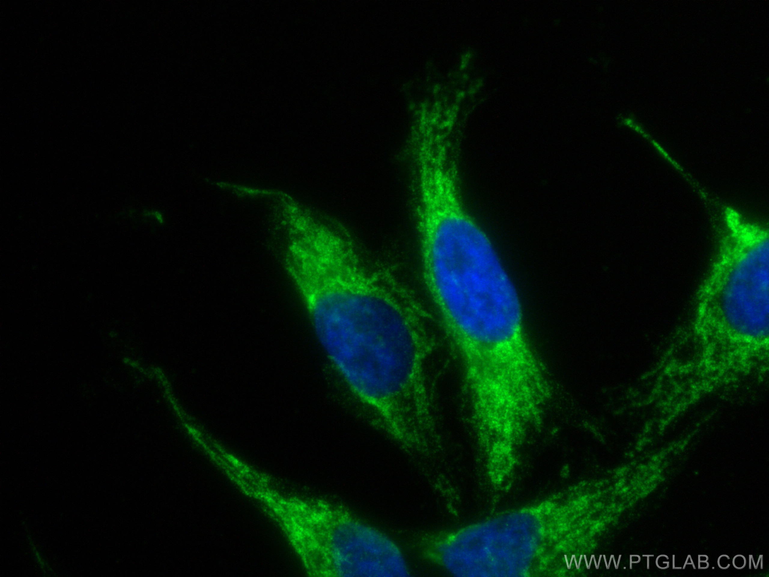 Immunofluorescence (IF) / fluorescent staining of HeLa cells using MAVS; VISA Recombinant antibody (81910-1-RR)