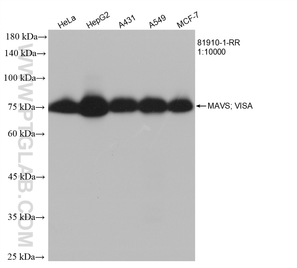 Western Blot (WB) analysis of various lysates using MAVS; VISA Recombinant antibody (81910-1-RR)
