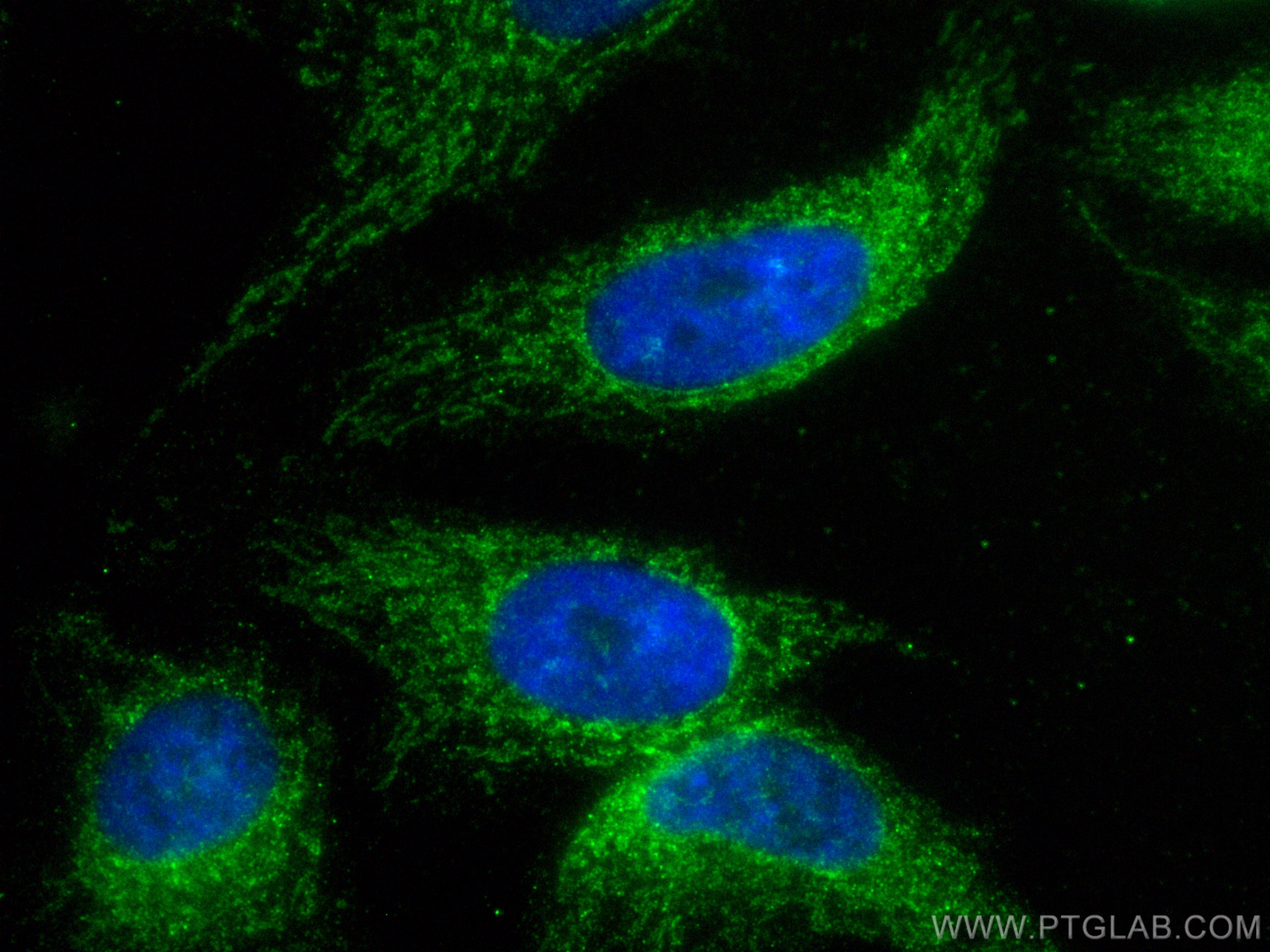 Immunofluorescence (IF) / fluorescent staining of HeLa cells using CoraLite® Plus 488-conjugated MAVS; VISA Recombina (CL488-81910)