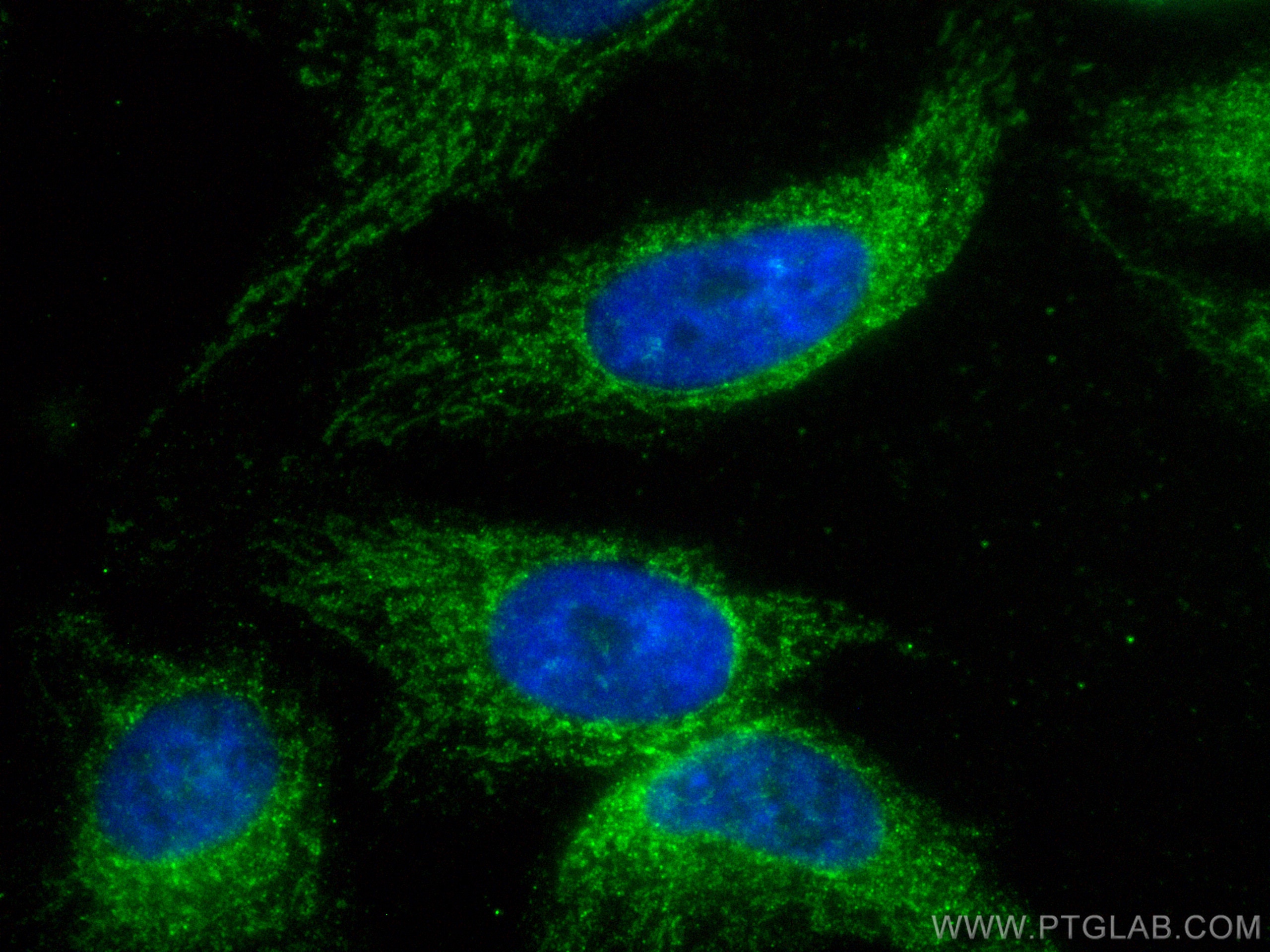 IF Staining of HeLa using CL488-81910