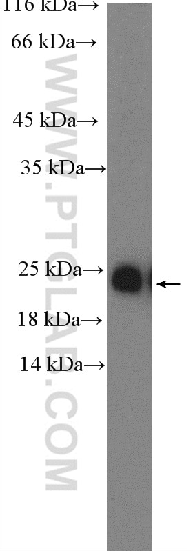 Western Blot (WB) analysis of HEK-293 cells using MAX Polyclonal antibody (10426-1-AP)